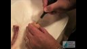 Misonix Bone scalpel egg demonstration